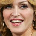 Madonna-dientes.jpg